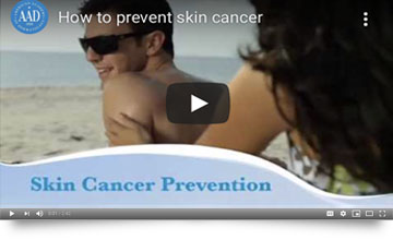 Cancer Prevention